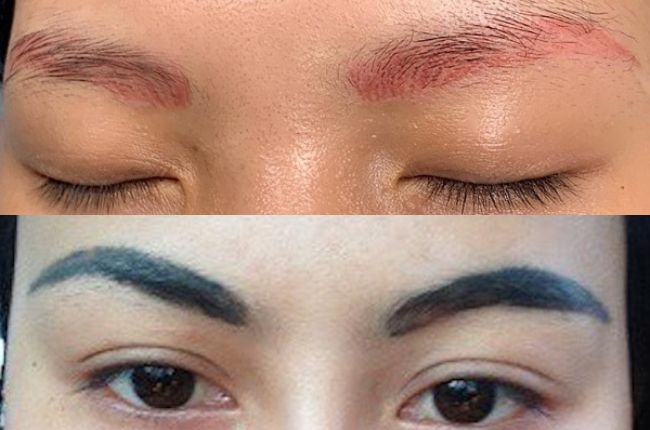 Có nhiều nguyên nhân dẫn đến hiện tượng lông mày trổ xanh